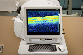 Eye Doctor in San Antonio